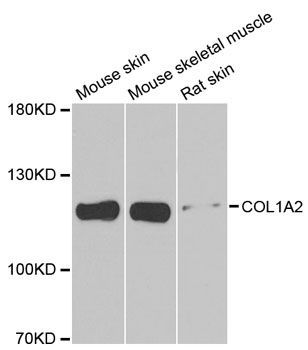 Western blot - COL1A2 antibody (144-05786)