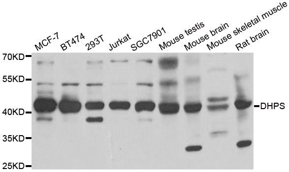 Western blot - DHPS antibody (144-06367)
