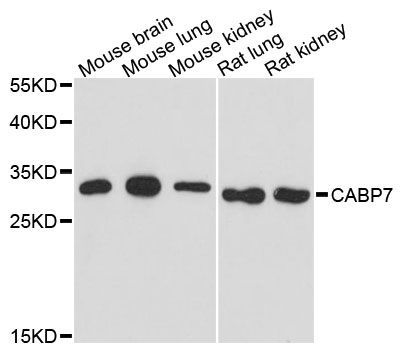 Western blot - CABP7 Polyclonal Antibody (144-013703)
