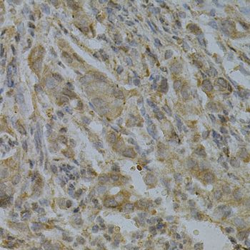 Immunohistochemistry - GGA2 Antibody (144-01186)