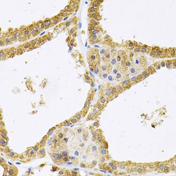 Immunohistochemistry - FHL1 Antibody (144-05460)