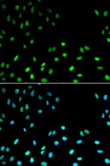 Immunofluorescence - RFC1 antibody (144-01625)