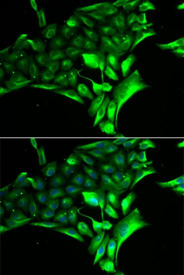 Western blot - PYGB Polyclonal Antibody (144-06402)