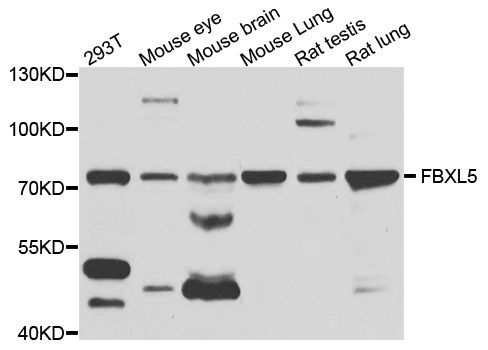 Western blot - FBXL5 antibody (144-05602)