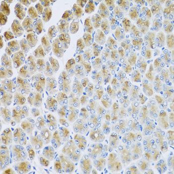Immunohistochemistry - AP1M2 antibody (144-08331)