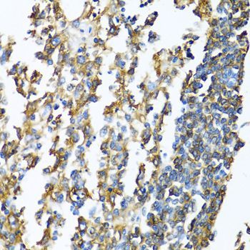 Immunohistochemistry - HLA-DPB1 Polyclonal Antibody (144-01412)