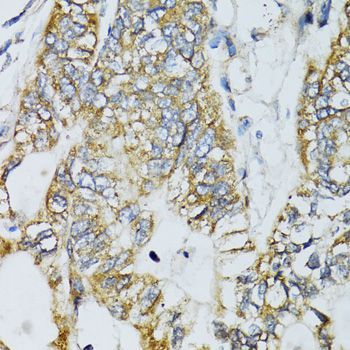 Western blot - ECSIT Polyclonal Antibody (144-07804)