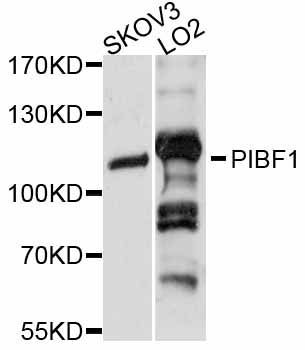 Western blot - PIBF1 antibody (144-012033)