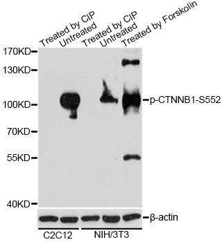 Western blot - Phospho-CTNNB1-S552 antibody (144-61506)