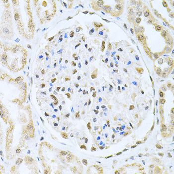 Immunohistochemistry - CBFB Antibody (144-05305)