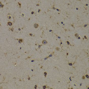Immunohistochemistry - EEF1D antibody (144-02509)