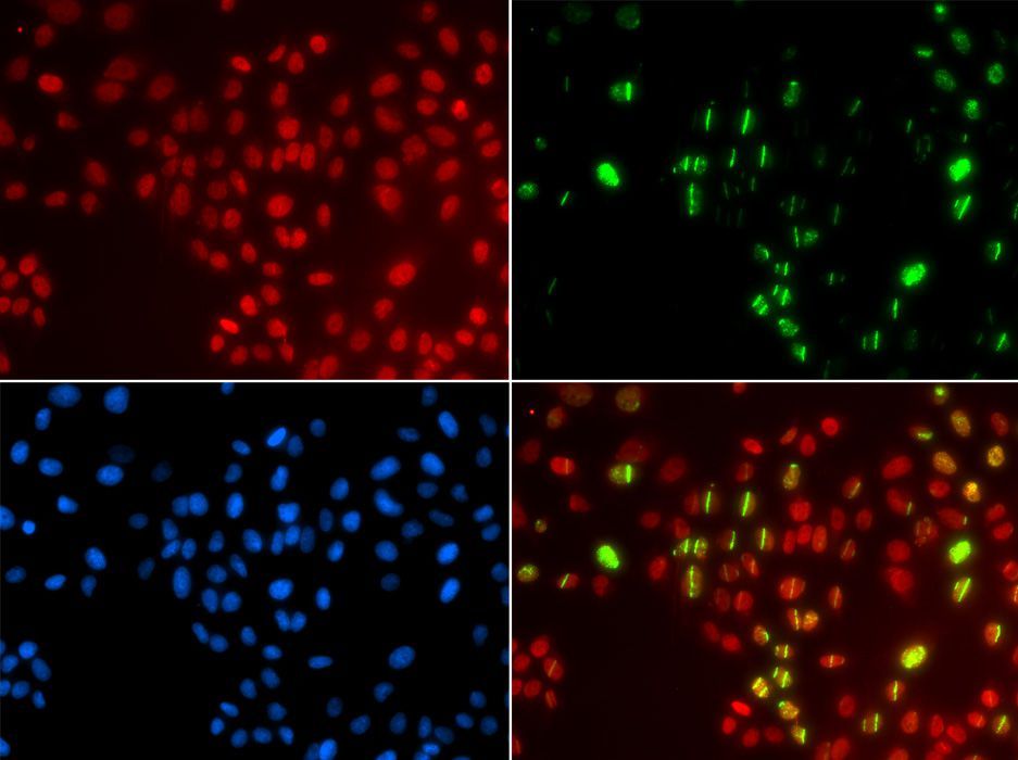 Immunofluorescence - POLH Polyclonal Antibody (144-01833)