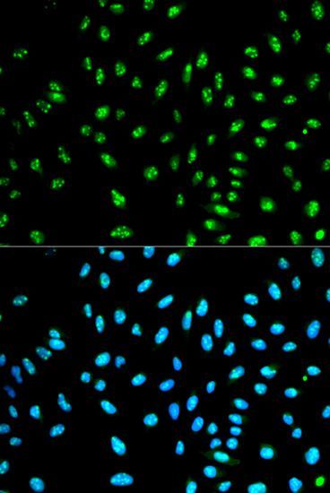 Immunofluorescence - NCF2 antibody (144-01178)