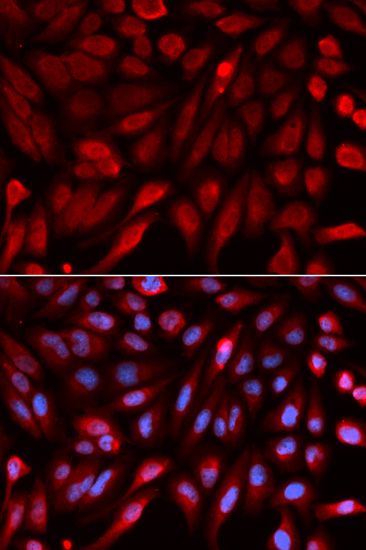 Immunofluorescence - SDCBP antibody (144-05360)
