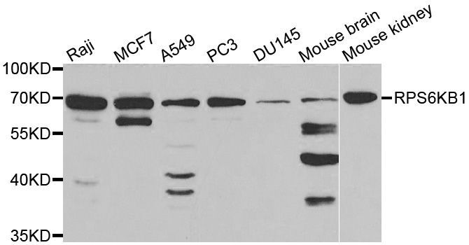 Western blot - RPS6KB1 antibody (144-02190)