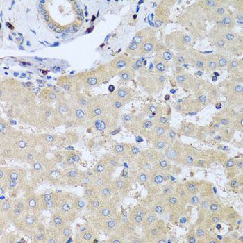 Immunohistochemistry - COTL1 antibody (144-04550)