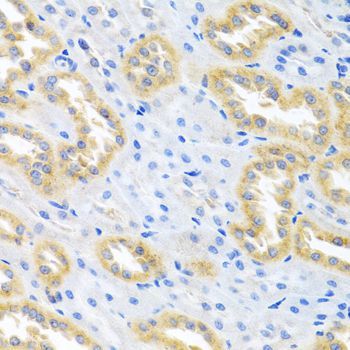 Immunohistochemistry - BMP3 antibody (144-06877)