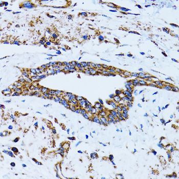 Immunohistochemistry - EIF2AK4 antibody (144-12618)