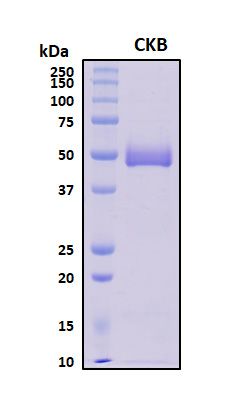 SDS-PAGE