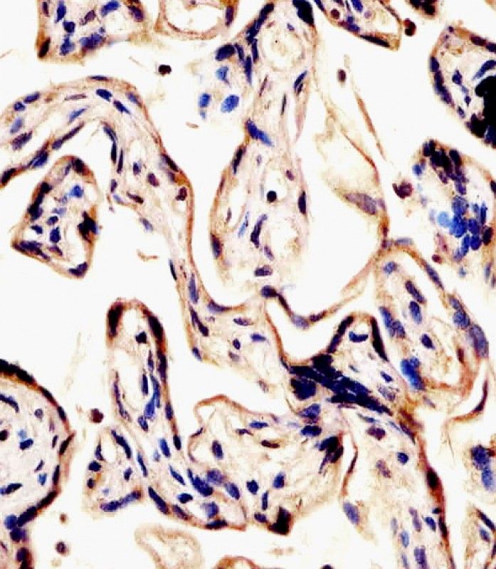 IHC-P