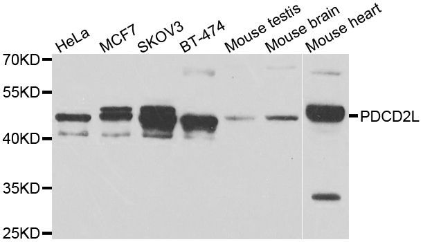 Western blot - PDCD2L Polyclonal Antibody (144-07394)