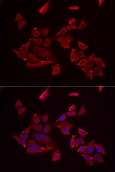 Immunofluorescence - RARRES2 antibody (144-06963)