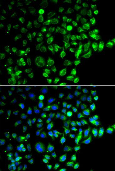 Immunofluorescence - RAB31 antibody (144-61369)