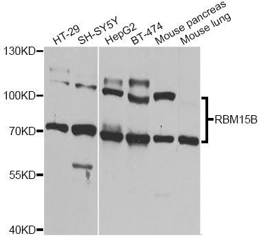 Western blot - RBM15B Antibody (144-09873)