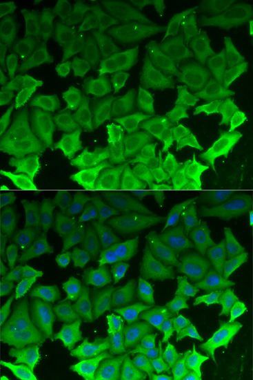 Western blot - [KO Validated] EEF2K Polyclonal Antibody (144-05404)