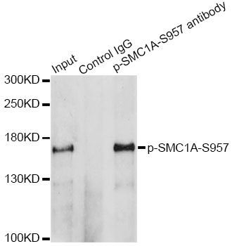 Immunoprecipitation - Phospho-SMC1A-S957 pAb (144-50090)