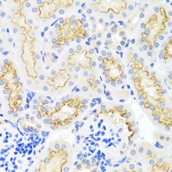 Immunohistochemistry - SRPX antibody (144-01217)