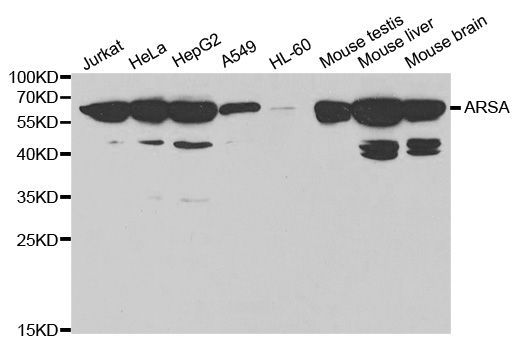 Western blot - ARSA antibody (144-01736)