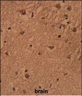 IHC-P