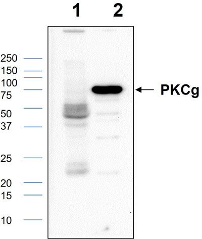 Western blot