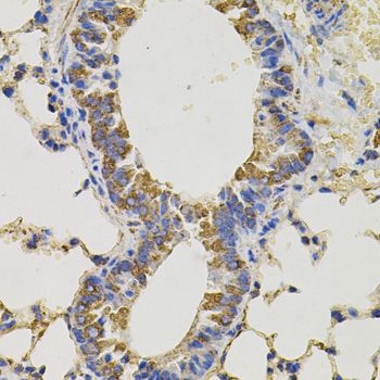 Immunohistochemistry - PTPRC antibody (144-02115)