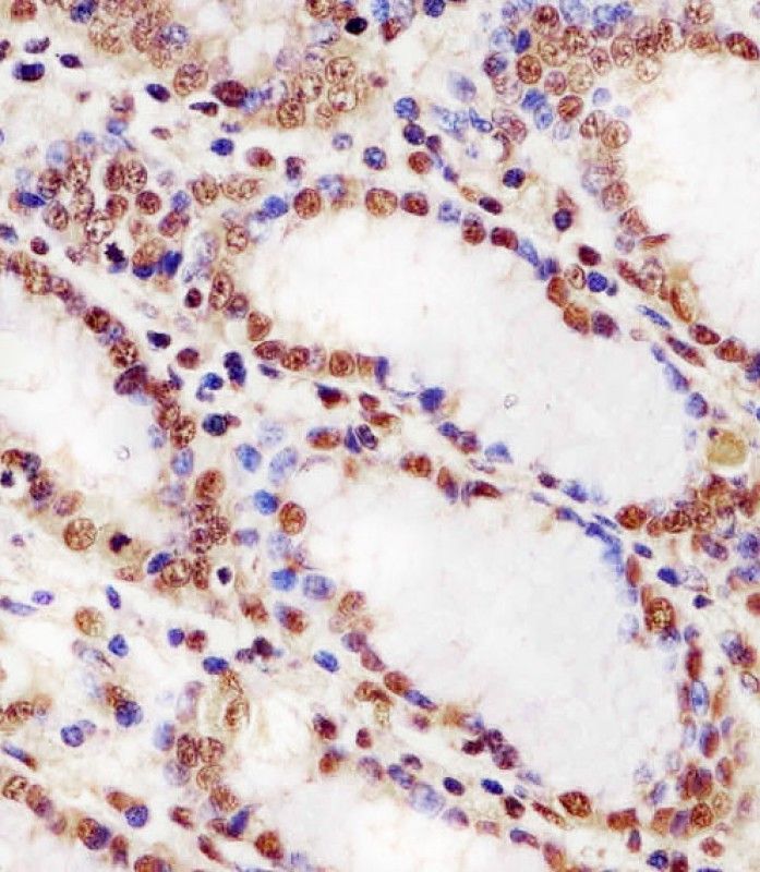 IHC-P