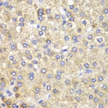 Immunohistochemistry - HADH Polyclonal Antibody (144-01076)