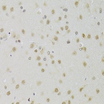 Immunohistochemistry - HEXIM1 Antibody (144-05775)