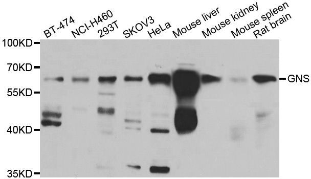 Western blot - GNS antibody (144-07489)