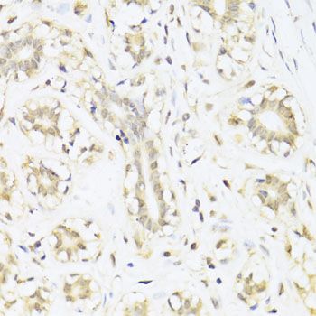 Immunohistochemistry - STAT1 Polyclonal Antibody (144-012075)