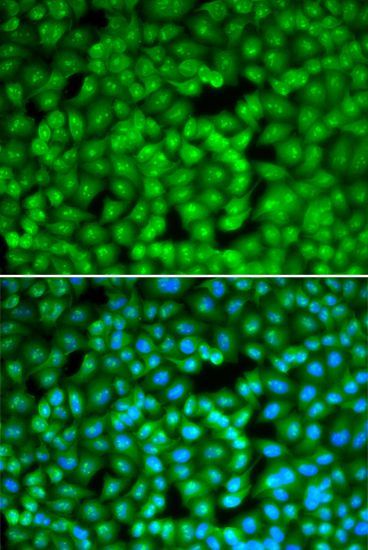 Immunofluorescence - FBL Polyclonal Antibody (144-60358)