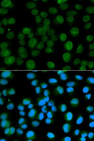 Immunofluorescence - EMD antibody (144-01132)