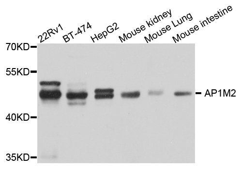 Western blot - AP1M2 antibody (144-08331)