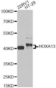 Western blot - HOXA13 antibody (144-60544)
