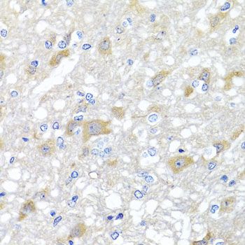Immunohistochemistry - INPP5K antibody (144-07807)
