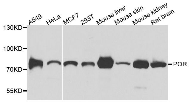 Western blot - [KO Validated] POR Polyclonal Antibody (144-08142)