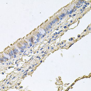 Immunohistochemistry - EPOR Polyclonal Antibody (144-02917)