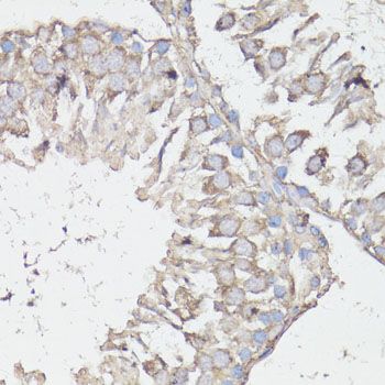 Immunohistochemistry - MTOR antibody (144-11355)