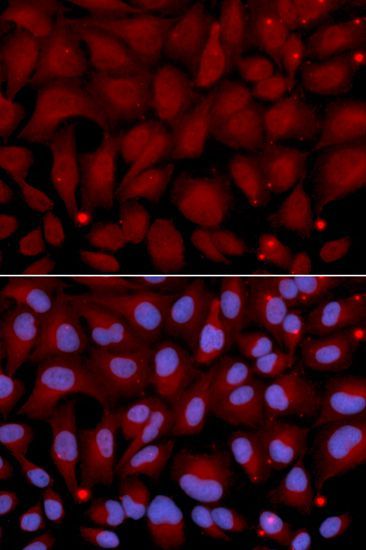 Immunohistochemistry - BCHE Polyclonal Antibody (144-01460)