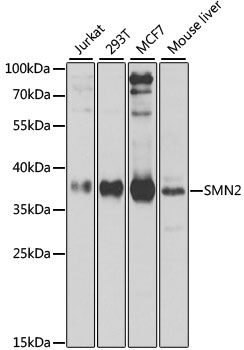 Western blot - SMN2 Polyclonal Antibody (144-012519)